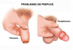 Esteroides definicion pdf