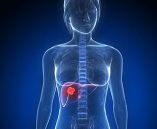 cancer de l'endomètre pronostic sequelles apres radiotherapie