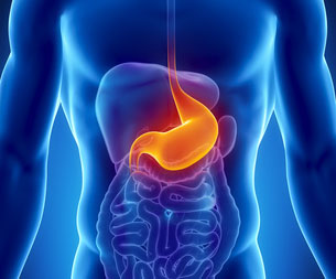 Gastrostomie