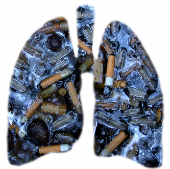 Cancer broncho-pulmonaire