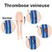 Les cliniques pour le traitement des varices variqueuses
