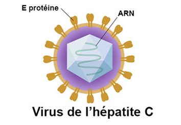 virus de l'hépatite C
