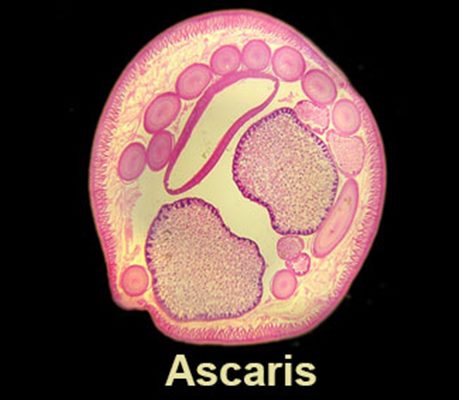 Ascaridiose