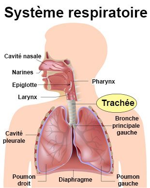 comment traiter tracheite