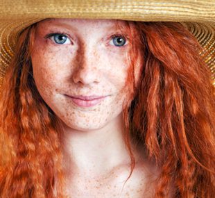 La crème bon marché des taches de pigment sur la personne