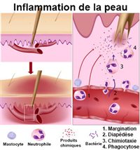 Longuent sulfurique 33 des taches de pigment