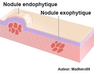Si on peut exprimer les boutons sur la personne et comme