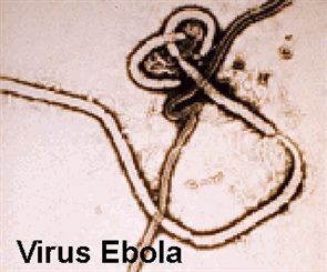 virus EBOLA
