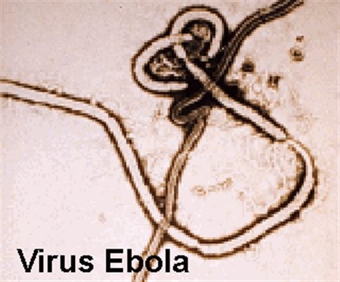 Virus EBOLA : symptômes et diagnostic   (OMS)