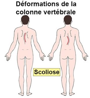 La vive douleur dans le dos rendant au coeur