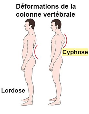 Fait mal le cou par derrière et la gorge fait mal
