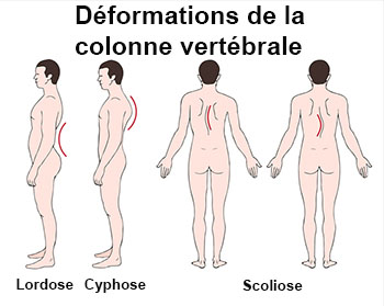 Si on transmet les taches de pigment