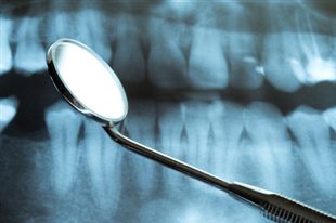 comment soulager la douleur d'un kyste dentaire