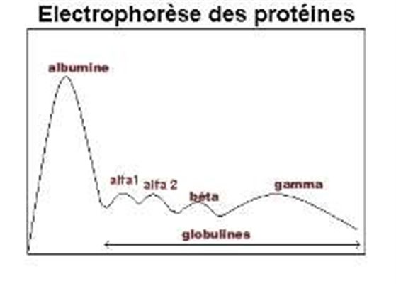 Électrophorèse des protéines