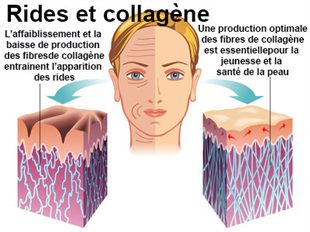que faire pour les rides