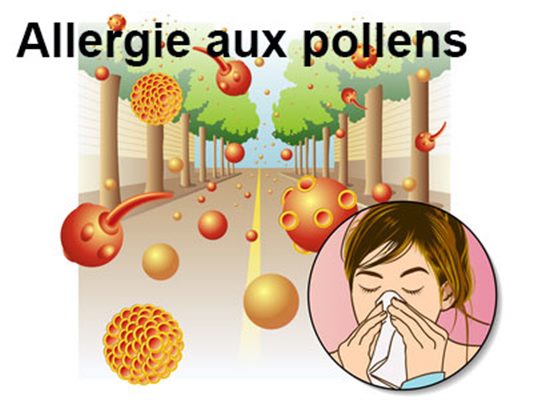 Allergie aux pollens