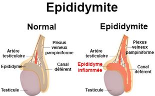 De la chirurgie vasculeuse du nom