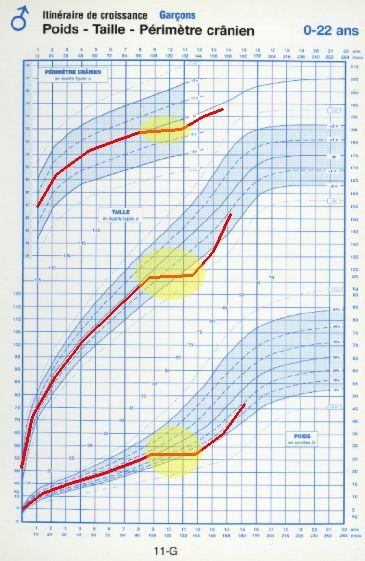 Troubles De La Croissance Symptomes Traitement Definition Docteurclic Com