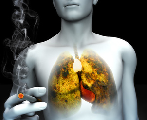 Effets du tabac, dangers du tabac : définition