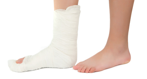 Fracture du pied : symptômes, traitement, définition - docteurclic.com