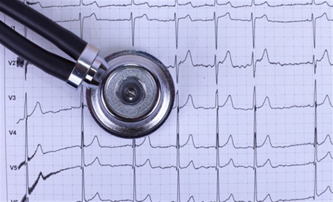 Électrocardiogramme ou ECG