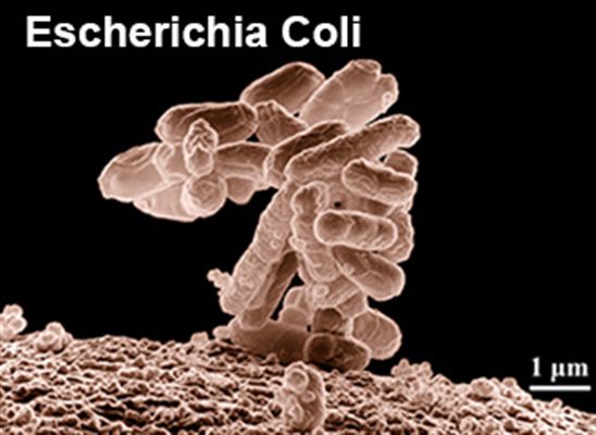 Intoxication alimentaire à Escherichia coli