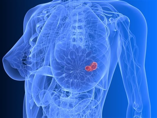 Néoplasie endocrinienne multiple de type 2