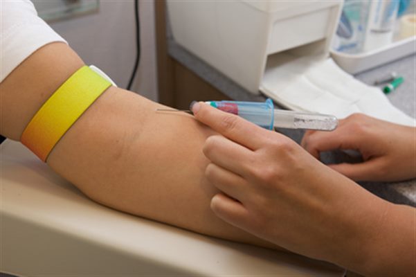 L'hypertension artérielle, examens et tests