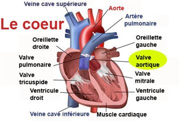 valve aortique