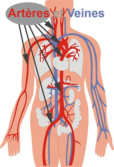 Infarctus mésentérique