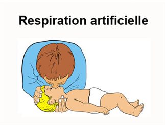 respiration artificielle