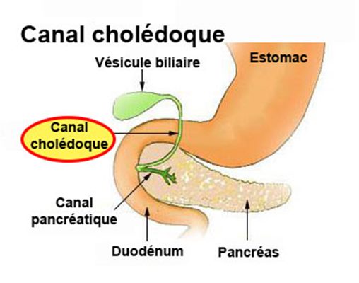 Canal cholédoque