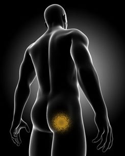 douleur de la fesse