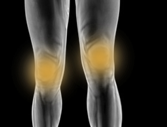 Douleurs du genou : symptômes, traitement, définition ...