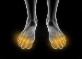 Douleur des orteils : symptômes, traitement, définition ...
