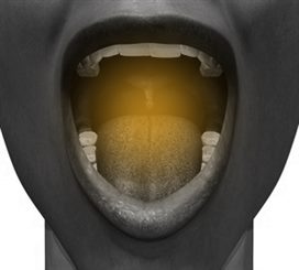 douleur dans la bouche