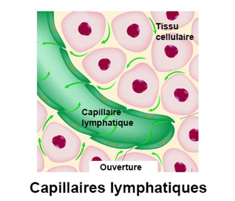 Lymphangite