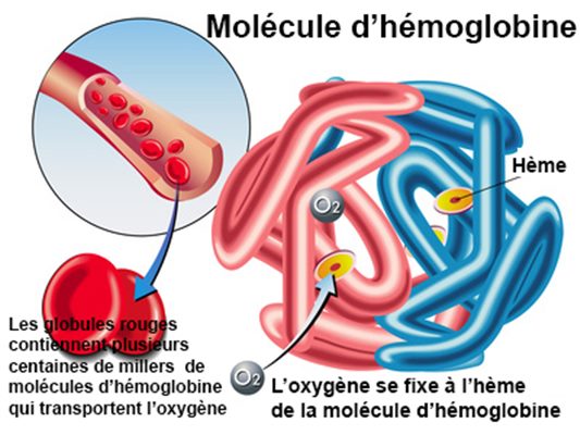 Hémoglobinopathies