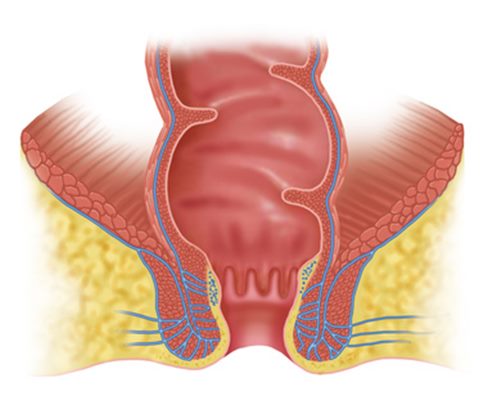 Cancer de l'anus : symptômes, traitement, définition - docteurclic.com