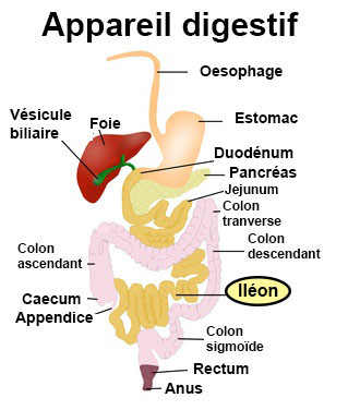 Iléostomie : définition, technique - docteurclic.com