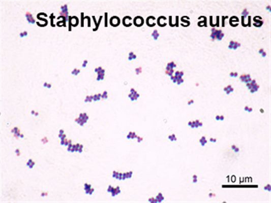 Liste des infections de la peau