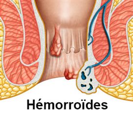 Selles anormales : symptômes, traitement, définition - docteurclic.com