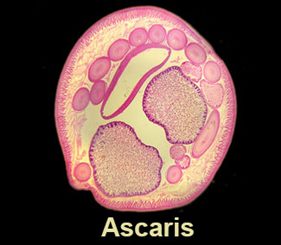 ascaris