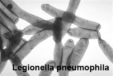 legionella pneumophila