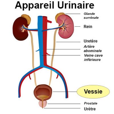 Maladies de la vessie