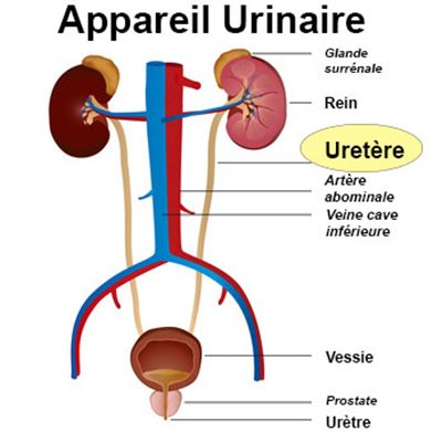 Urétérostomie