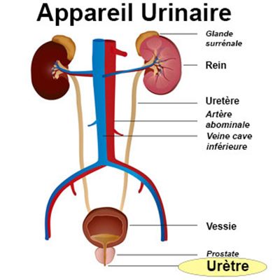 Maladies de l'urètre