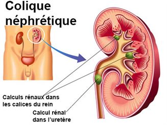 Douleur bas ventre : questions réponses santé - docteurclic.com