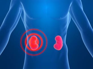 inflammation du rein