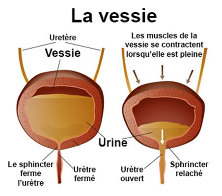 Rétention urinaire